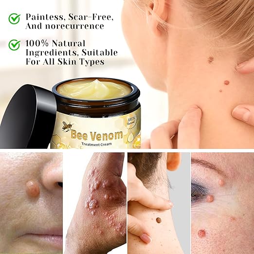 Bee Venom Cream for All Body Parts كريم سمّ النحل لجميع أجزاء الجسم