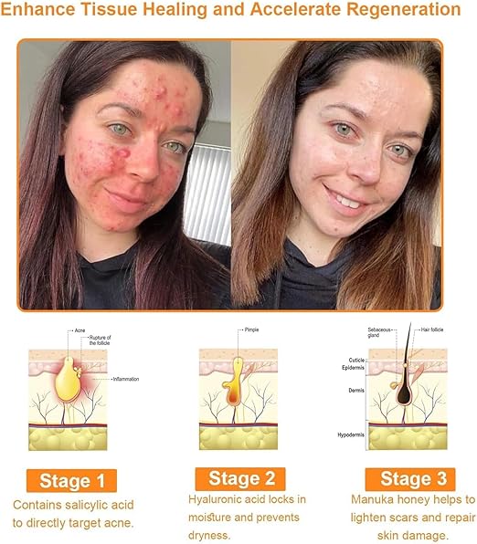 Bee Venom Cream for All Body Parts    كريم سمّ النحل لجميع أجزاء الجسم