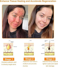 Bee Venom Cream for All Body Parts    كريم سمّ النحل لجميع أجزاء الجسم