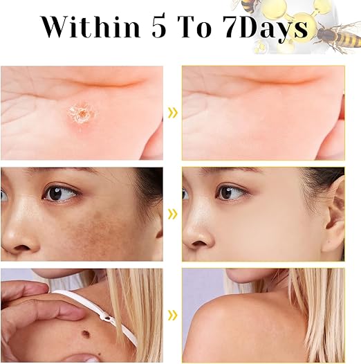 Bee Venom Cream for All Body Parts    كريم سمّ النحل لجميع أجزاء الجسم
